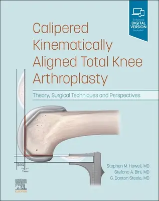 Arthroplastie totale du genou à alignement cinématique Calipered : Théorie, techniques chirurgicales et perspectives - Calipered Kinematically Aligned Total Knee Arthroplasty: Theory, Surgical Techniques and Perspectives