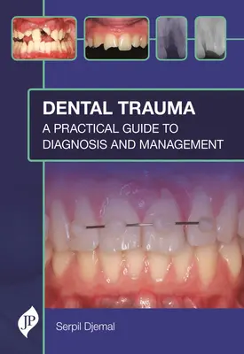 Traumatisme dentaire : Guide pratique de diagnostic et de gestion - Dental Trauma: A Practical Guide to Diagnosis and Management