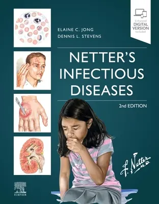 Les maladies infectieuses de Netter - Netter's Infectious Diseases