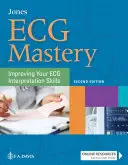 Maîtrise de l'ECG : Améliorer vos compétences en matière d'interprétation de l'ECG - ECG Mastery: Improving Your ECG Interpretation Skills