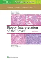 Interprétation de la biopsie du sein - Biopsy Interpretation of the Breast