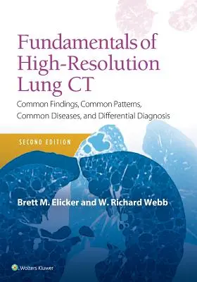 Fondamentaux de la tomodensitométrie pulmonaire à haute résolution : résultats courants, schémas courants, maladies courantes et diagnostic différentiel - Fundamentals of High-Resolution Lung CT: Common Findings, Common Patterns, Common Diseases and Differential Diagnosis