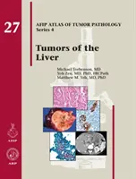 Tumeurs du foie - Tumors of the Liver