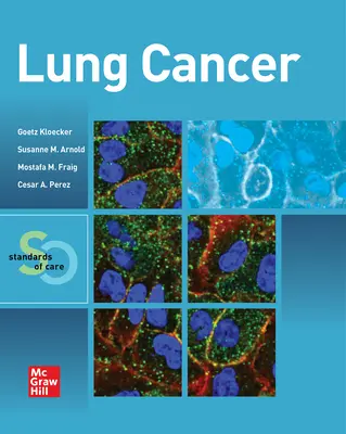 Cancer du poumon : Normes de soins - Lung Cancer: Standards of Care