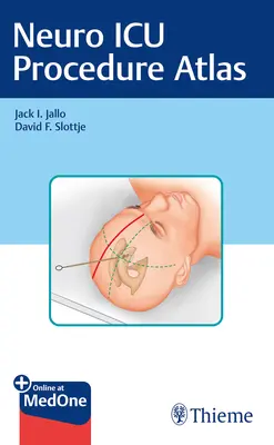 Atlas des procédures de l'unité de soins intensifs en neurologie - Neuro ICU Procedure Atlas