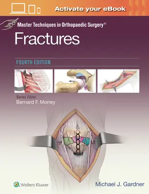 Techniques de base en chirurgie orthopédique : Fractures - Master Techniques in Orthopaedic Surgery: Fractures