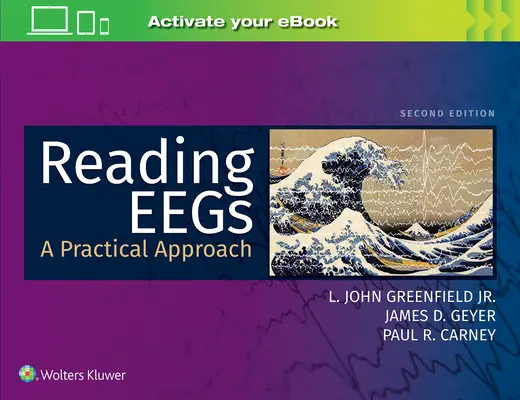 Lire les Eegs : Une approche pratique - Reading Eegs: A Practical Approach