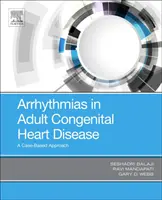 Arythmies dans les cardiopathies congénitales de l'adulte : Une approche basée sur les cas - Arrhythmias in Adult Congenital Heart Disease: A Case-Based Approach