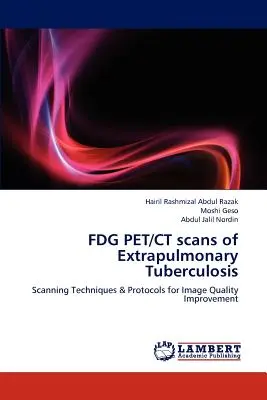 TEP/CT au FDG dans la tuberculose extrapulmonaire - FDG PET/CT scans of Extrapulmonary Tuberculosis