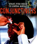 Ce qu'il faut savoir sur la conjonctivite - What You Need to Know about Conjunctivitis