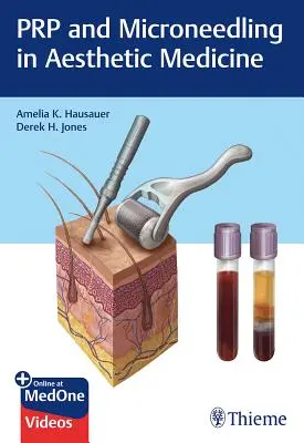 Prp et Microneedling en médecine esthétique - Prp and Microneedling in Aesthetic Medicine