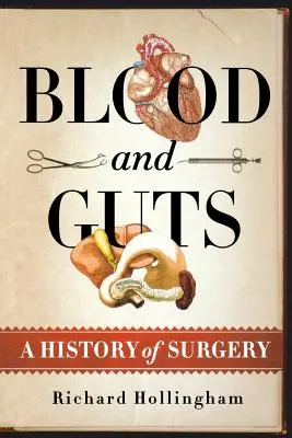 Le sang et les tripes : Une histoire de la chirurgie - Blood and Guts: A History of Surgery