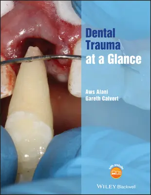 Traumatisme dentaire en un coup d'œil - Dental Trauma at a Glance