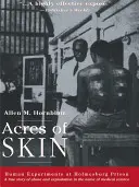 Acres of Skin : Expériences humaines à la prison de Holmesburg - Acres of Skin: Human Experiments at Holmesburg Prison