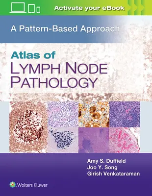 Atlas de la pathologie des ganglions lymphatiques : Une approche basée sur les modèles - Atlas of Lymph Node Pathology: A Pattern Based Approach