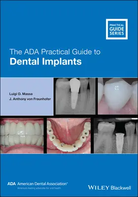 Le guide pratique de l'ADA sur les implants dentaires - The ADA Practical Guide to Dental Implants