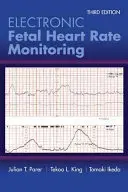 Surveillance électronique du rythme cardiaque fœtal : Le système à 5 niveaux : Le système à 5 niveaux - Electronic Fetal Heart Rate Monitoring: The 5-Tier System: The 5-Tier System