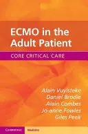 L'ECMO chez le patient adulte - ECMO in the Adult Patient