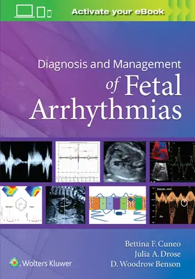 Diagnostic et gestion des arythmies fœtales - Diagnosis and Management of Fetal Arrhythmias