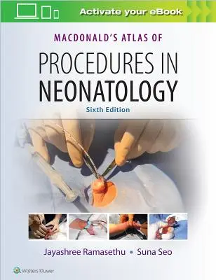 Atlas des procédures en néonatologie de Macdonald - Macdonald's Atlas of Procedures in Neonatology