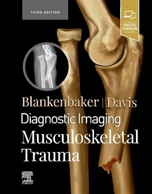 Imagerie diagnostique : Traumatismes musculo-squelettiques - Diagnostic Imaging: Musculoskeletal Trauma