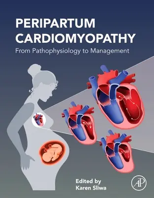 Cardiomyopathie du péripartum : De la physiopathologie à la prise en charge - Peripartum Cardiomyopathy: From Pathophysiology to Management