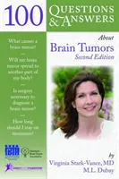 100 questions et réponses sur les tumeurs cérébrales - 100 Questions  &  Answers About Brain Tumors