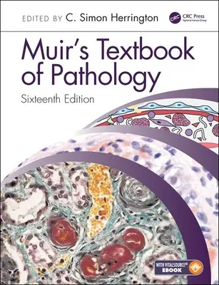 Le manuel de pathologie de Muir - Muir's Textbook of Pathology