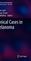 Cas cliniques de mélanome - Clinical Cases in Melanoma