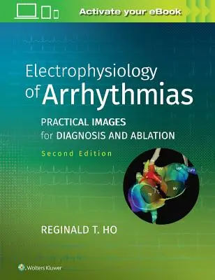 Electrophysiologie des arythmies : Images pratiques pour le diagnostic et l'ablation - Electrophysiology of Arrhythmias: Practical Images for Diagnosis and Ablation