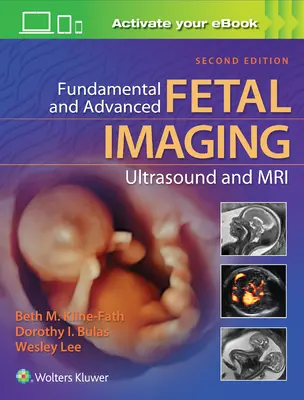 Imagerie fœtale fondamentale et avancée : échographie et IRM - Fundamental and Advanced Fetal Imaging Ultrasound and MRI