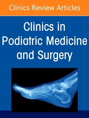 Cavus Foot Deformity, an Issue of Clinics in Podiatric Medicine and Surgery, 38 (en anglais) - Cavus Foot Deformity, an Issue of Clinics in Podiatric Medicine and Surgery, 38