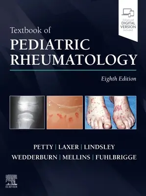 Manuel de rhumatologie pédiatrique - Textbook of Pediatric Rheumatology