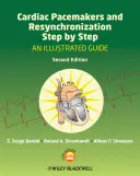 Pacemakers cardiaques et resynchronisation pas à pas : Un guide illustré - Cardiac Pacemakers and Resynchronization Step by Step: An Illustrated Guide
