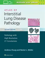 Atlas de la pathologie des maladies pulmonaires interstitielles - Atlas of Interstitial Lung Disease Pathology