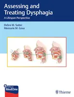 Évaluation et traitement de la dysphagie : une perspective à vie - Assessing and Treating Dysphagia: A Lifespan Perspective