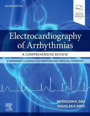 L'électrocardiographie des arythmies : Une revue complète - Electrocardiography of Arrhythmias: A Comprehensive Review