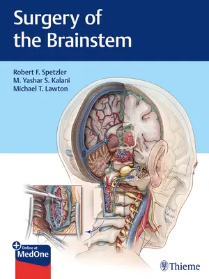 Chirurgie du tronc cérébral - Surgery of the Brainstem