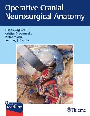 Anatomie neurochirurgicale crânienne opératoire - Operative Cranial Neurosurgical Anatomy