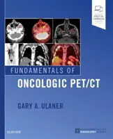 Principes fondamentaux de l'oncologie Pet/CT - Fundamentals of Oncologic Pet/CT