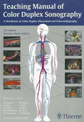 Manuel d'enseignement de l'échographie duplex couleur - Teaching Manual of Color Duplex Sonography