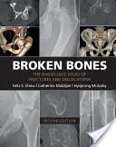 Les os brisés : L'Atlas radiologique des fractures et des luxations - Broken Bones: The Radiologic Atlas of Fractures and Dislocations