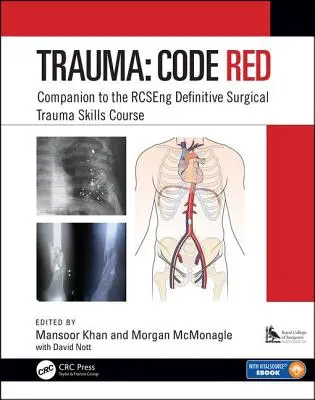 Trauma : Code Rouge : Companion to the Rcseng Definitive Surgical Trauma Skills Course (compagnon du cours définitif de compétences en traumatologie chirurgicale du Rcseng) - Trauma: Code Red: Companion to the Rcseng Definitive Surgical Trauma Skills Course