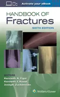 Manuel des fractures - Handbook of Fractures