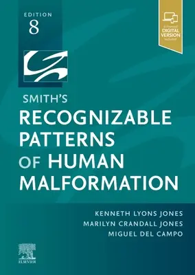 Smith's Recognizable Patterns of Human Malformation (en anglais) - Smith'S Recognizable Patterns of Human Malformation