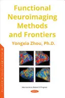 Méthodes et frontières de la neuroimagerie fonctionnelle - Functional Neuroimaging Methods and Frontiers