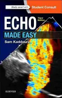 L'écho en toute simplicité - Echo Made Easy