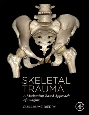 Traumatismes du squelette - Une approche de l'imagerie basée sur les mécanismes (Bierry Guillaume (Hôpital universitaire de Strasbourg France)) - Skeletal Trauma - A Mechanism-Based Approach of Imaging (Bierry Guillaume (University Hospital Strasbourg France))