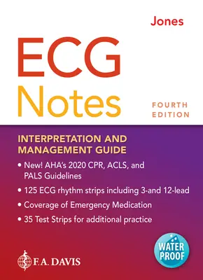 ECG Notes : Guide d'interprétation et de gestion - ECG Notes: Interpretation and Management Guide