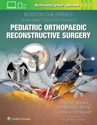 Boston Children's Illustrated Tips and Tricks in Pediatric Orthopaedic Reconstructive Surgery (en anglais) - Boston Children's Illustrated Tips and Tricks in Pediatric Orthopaedic Reconstructive Surgery